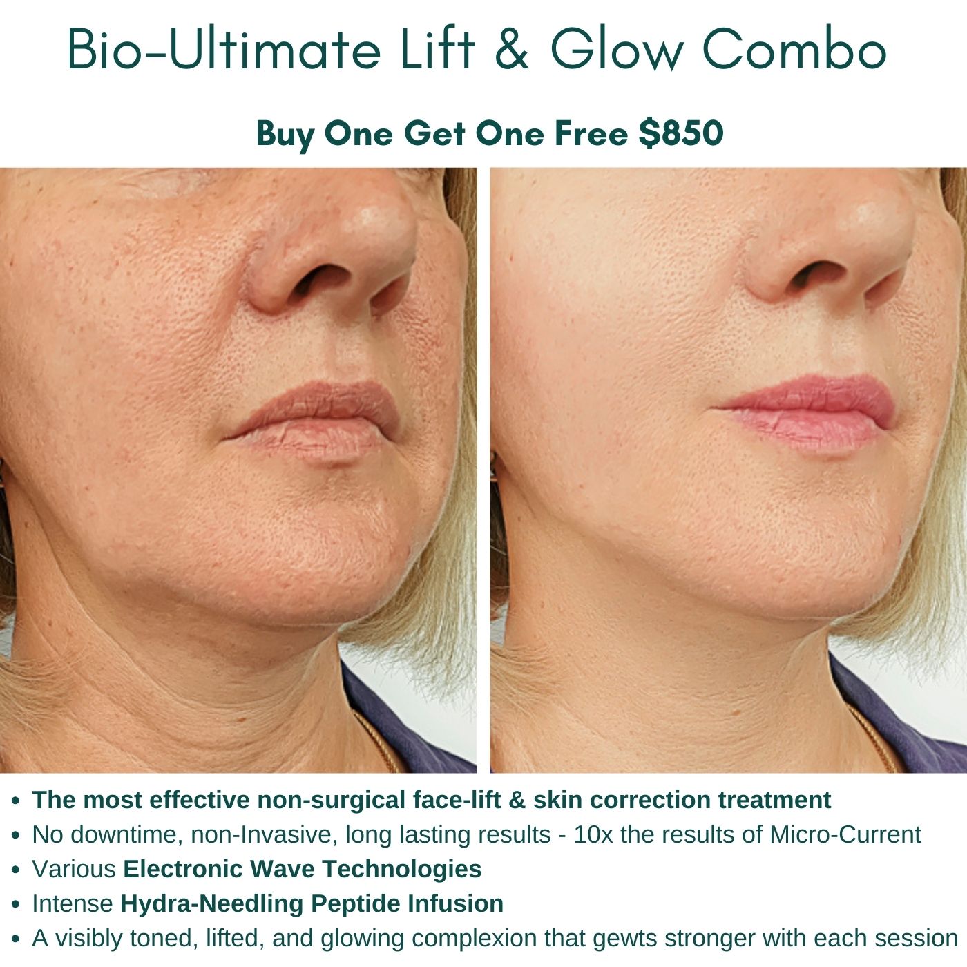 Bio-LIFT Facial Treatment