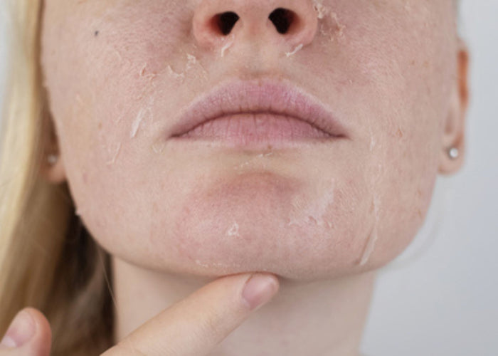In Spa Treatment - Bio-Luméa Trifecta Skin Perfection 3 Treatment Seri