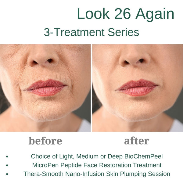 In-Spa Treatment: Look 26 Again 3-Treatment Series by Pure Skin Science
